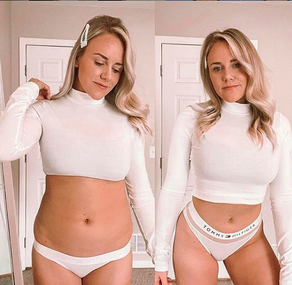 9. Это не принято показывать в Инстаграм, но у многих людей есть жировые складки, целлюлит и прыщи.