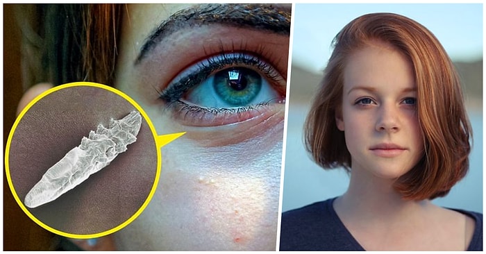 Geceleri Mışıl Mışıl Uyuduğunuzu Düşünürken Yüzünüzde Milyonlarca Böceğin Kamp Yaptığını Biliyor muydunuz?