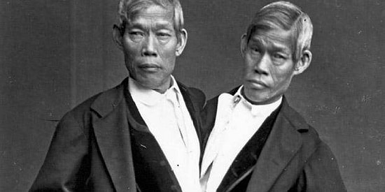 Farklılıkları Yüzünden Hayatları Boyunca Sirklerde Yer Almış 13 İnsan