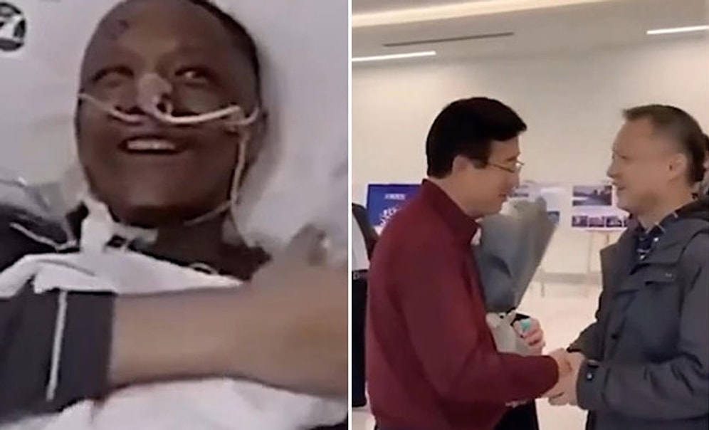 Koronavirüs Sonrası Ten Rengi Değişen Çinli Doktor Normale Döndü