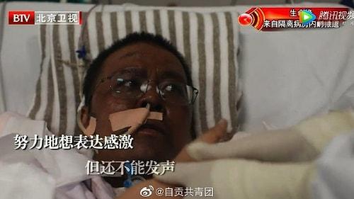 Koronavirüs Sonrası Ten Rengi Değişen Çinli Doktor Normale Döndü