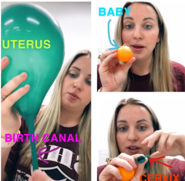 Видео, в котором мяч для пинг-понга представлялся младенцем, а воздушный шар - маткой, за короткое время посмотрели пять миллионов человек.