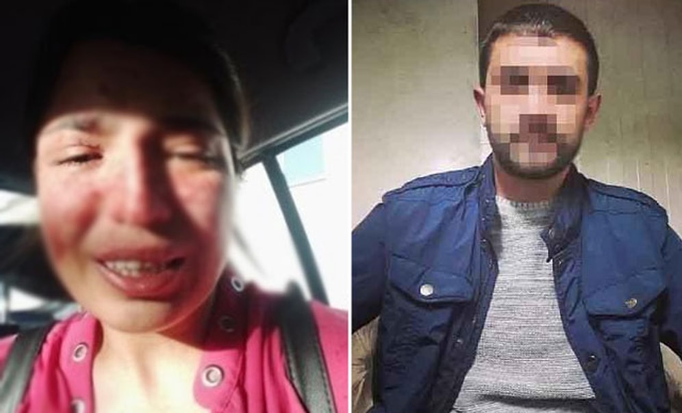 Boşandığı Eşinden Şiddet Gören Sibel'den Sosyal Medyada Yardım Çığlığı: 'Ben Ölmeden Sesim Olun'