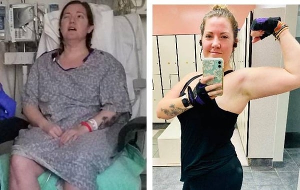 2. "9 месяцев назад я очнулась после операции на головном мозге и была парализована. А сегодня я могу обнять и поцеловать своих детей и активно занимаюсь спортом".