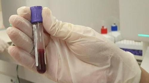 Koronavirüse Karşı Genetik Yatkınlık Testi Yapılıyor