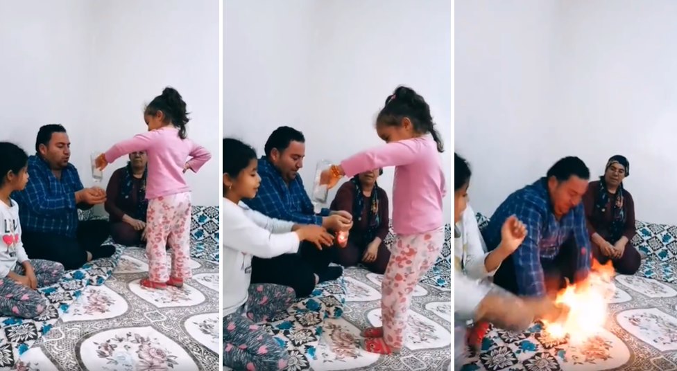 Kızının Eline Kolonya Döktüğü Eşini Çocuklarının Yanında Ateşe Veren