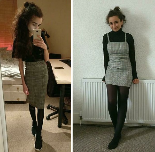 3. Восстановление от анорексии. Здорово снова познать себя и научиться ценить себя не только за свой вес