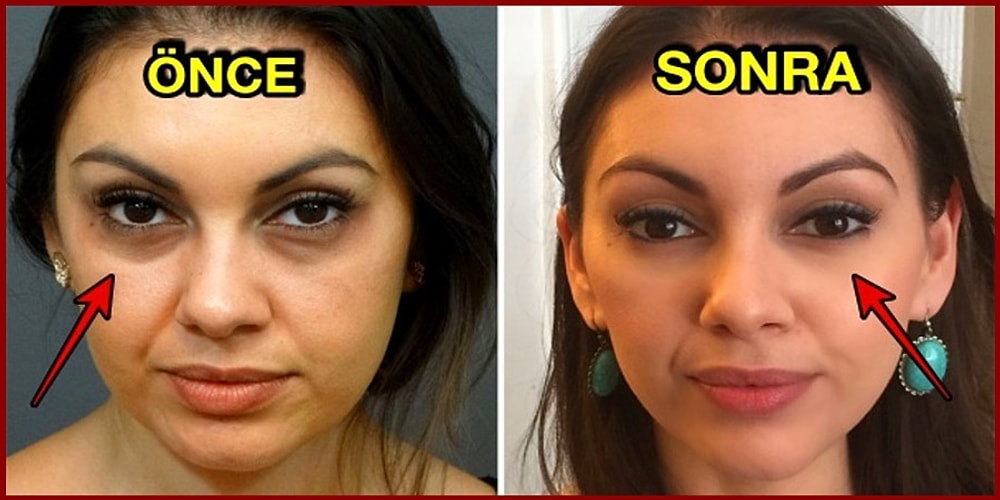 Göz Altı Torbalarını, Kırışıklıkları ve Morlukları Geçirmek İçin Hangi Ürünleri Kullanmalı ve Neler Yapmalıyız?