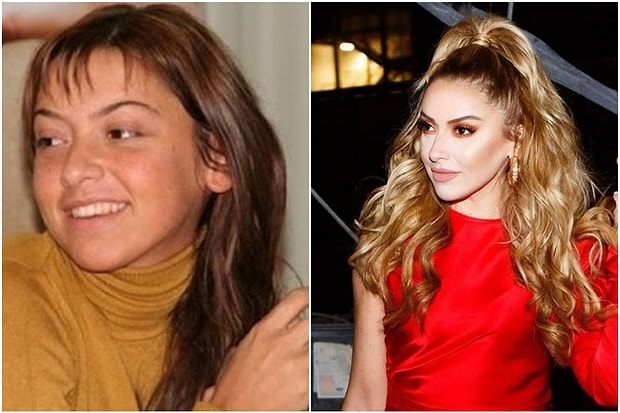 O Eski Halinden Eser Yok Simdi Yaptirdiklari Estetikler Ile Bambaska Birine Donusen 18 Unlu O Eski Halinden Eser Yok Simdi Yaptirdiklari Estetikler Ile Bambaska Birine Donusen 18 Unlu