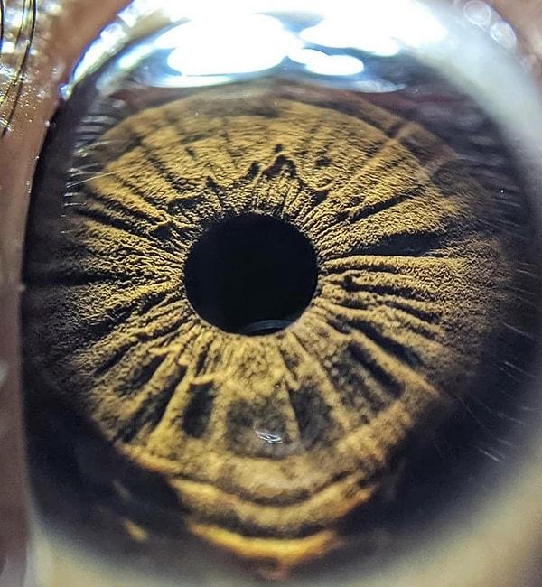 15. "Mikroskop altında bir insanın gözü:"