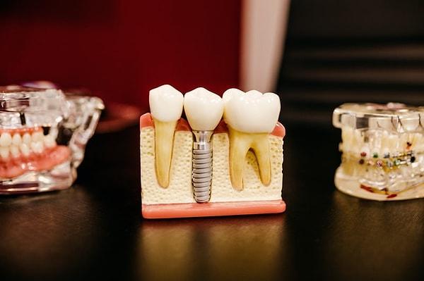 Tükürüğümüz ise içinde kalsiyum bulundurduğu için biraz da olsa diş minemizi iyileştirebilir.