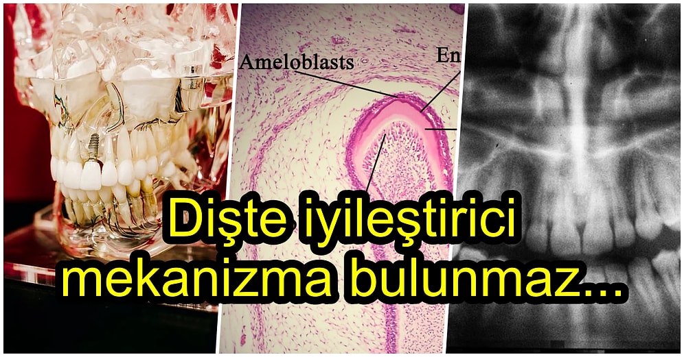 Dişlerimiz Neden Derimiz ve Kemiklerimiz Gibi Kendi Kendine İyileşemez?