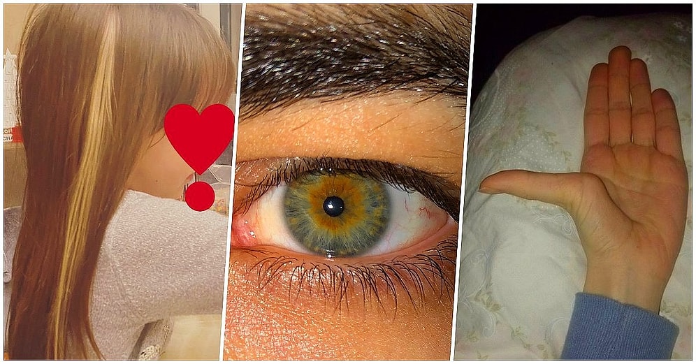 Sahip Oldukları Birbirinden Değişik Genetik Mutasyonları Paylaşırken Gören Herkesi Şaşırtan 19 Takipçimiz