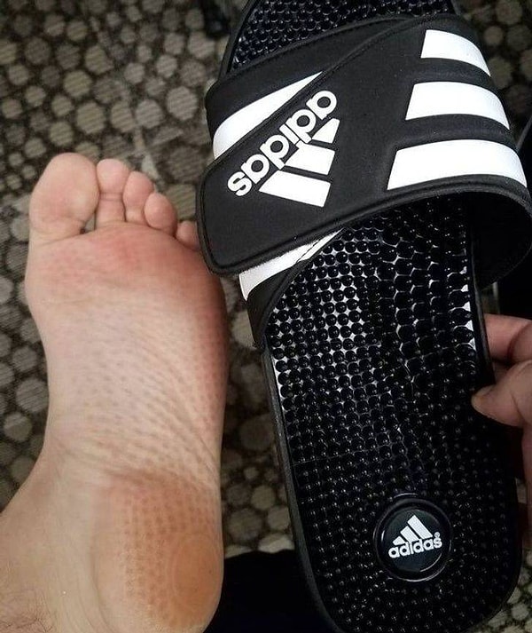 3. "Ужасно болит стопа! Кто, черт возьми, подумал, что это хорошая идея?!"