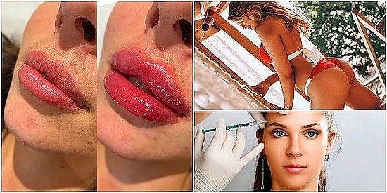 Dünyanın Parasını Dökmeden Önce Bilmekte Fayda Var: Estetik Operasyonların Pek Bilinmeyen Gerçek Sonuçları