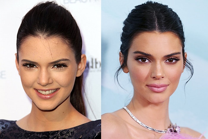 10 знаменитостей, которые теперь выглядят совершенно иначе, чем 10 лет назад