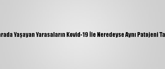 Kamboçya'da Mağarada Yaşayan Yarasaların Kovid-19 İle Neredeyse Aynı Patojeni Taşıdıkları Belirlendi