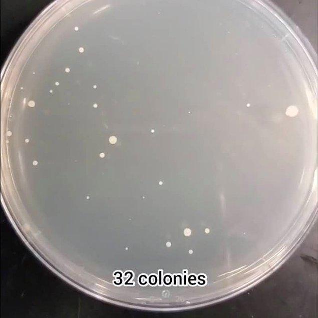 Elma: 32 bakteri kolonisi