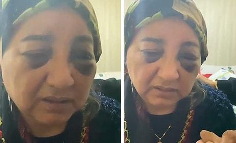 Eşini Gözleri Morarıncaya Kadar Dövüp Aç Bırakan Koca Tutuklandı