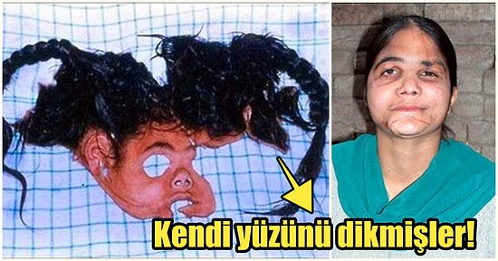 Bakmadan Geçmeyin! Modern Tıbbın Mucizesi Yüz Nakli Operasyonu Nasıl Gerçekleşir?