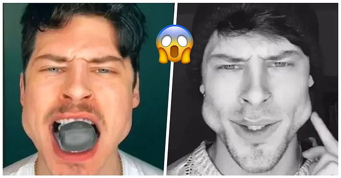 İki Ay Boyunca Jawline Egzersizi Yaparak Yüzünü Tamamen Değiştirdiğini İddia Eden Model