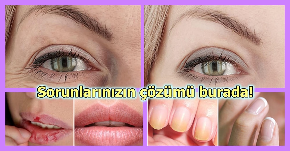 Çözümünü Bulduğunuzda Rahat Bir Nefes Alacağınız 17 Şey