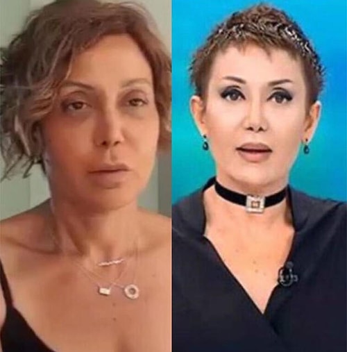 Yaptırdığı Estetiklerle Bambaşka Birine Dönüşen Serap Paköz'ün Yeni Hali Herkesi Şaşırttı!