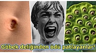 Bu Nasıl Bir Korku Diyeceğiniz 29 Enteresan Fobi