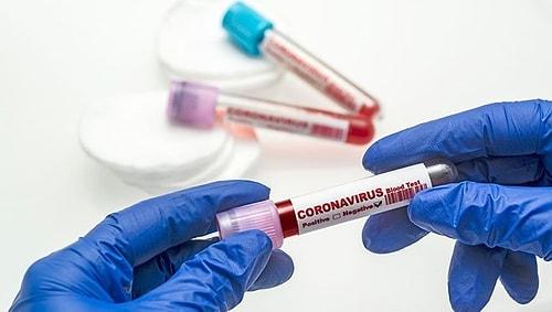 16 Ağustos Koronavirüs Tablosu Açıklandı: Yeni Hadise Sayısı 18 Bin 163