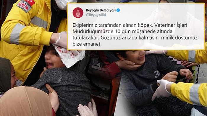 8 Yaşındaki Çocuk Kafasından Isırıldı, Belediyenin 'Minik Dostumuz' Tweeti Tepkilere Neden Oldu