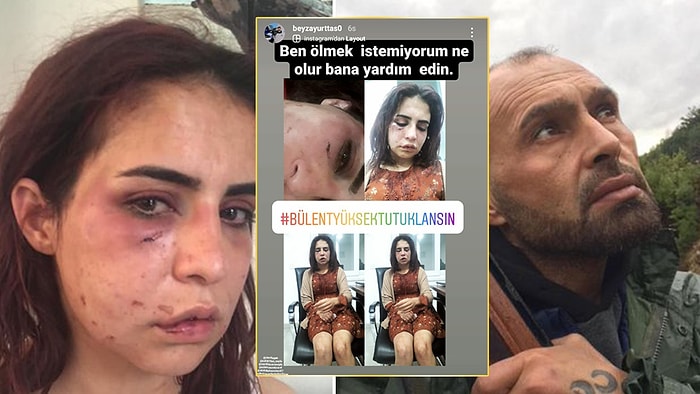 Eski Sevgilisi Tarafından Darp Edilen Kadının Yardım Çığlığı: 'Ölmek İstemiyorum'