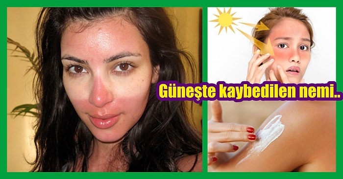 Cildinizi Güneşin Zararlı Etkilerinden Korumak İçin Neler Yapabilirsiniz?