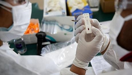 Oxford Üniversitesi 57 Bin Lira Karşılığında Yeniden Koronavirüse Yakalanmayı Kabul Edecek Gönüllüler Arıyor