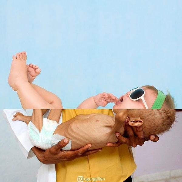 15. Hasta Yemenli bir çocuk!