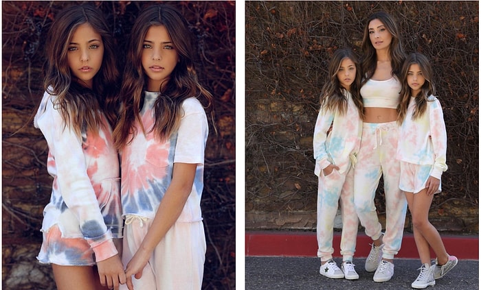 Самые красивые близнецы в мире: чем они занимаются?