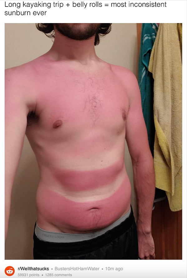 7. Ну подрумянишься немножко, это даже к лицу!