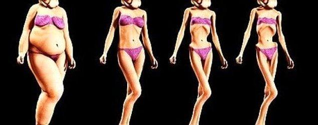 13. Arjantinli kadınlarda sık görülen öldürücü hastalık: Anoreksiya nevroza