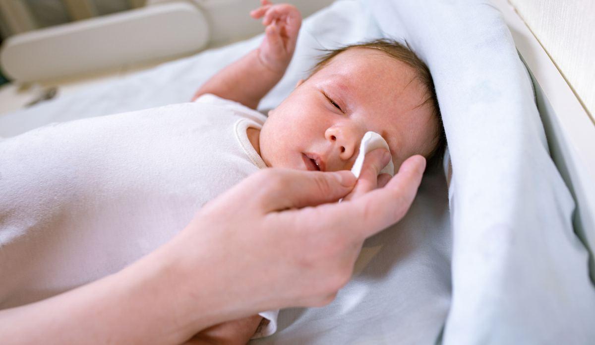 Bebeklerde Göz Kaşıntısı ve Kızarması Nedenleri Nelerdir? Bebeklerde