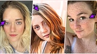 Vücutlarındaki Benzersiz Farklılıklarla Güzellik Algınızı Yerinden Oynatacak Birbirinden Eşsiz 18 İnsan