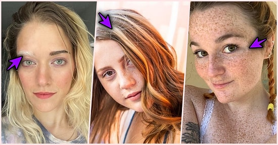 Vücutlarındaki Benzersiz Farklılıklarla Güzellik Algınızı Yerinden Oynatacak Birbirinden Eşsiz 18 İnsan