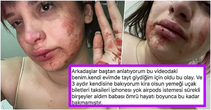 Ne Zaman Duracaksınız? Tayt Giydiği İçin Fiziksel ve Psikolojik Şiddet Gören Başak'ın Size Anlatacakları Var!