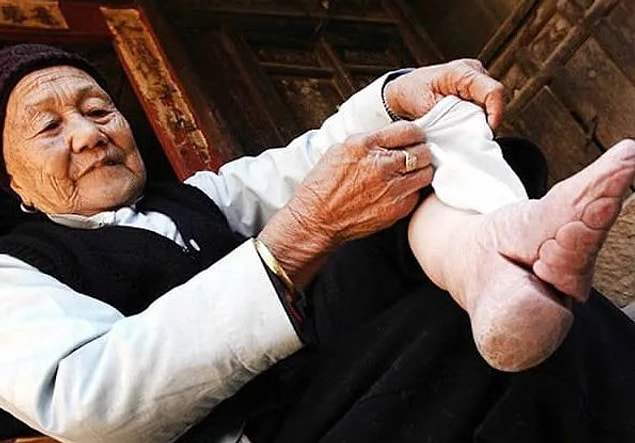 8. Akıllara durgunluk veren bir güzellik akımı da Çin'deki ultra küçük ayaklara duyulan ilgiydi.