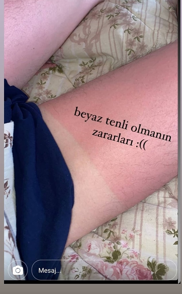 3. Daha çok güneş koruyucu kullanmadan uzun süre güneşte kalmanın zararları gibi.