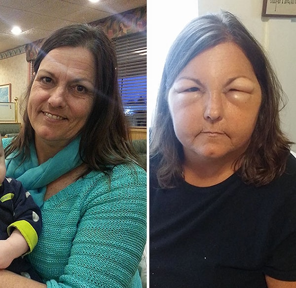 10. Что-то мне подсказывает, что у моей мамы аллергия на краску для волос