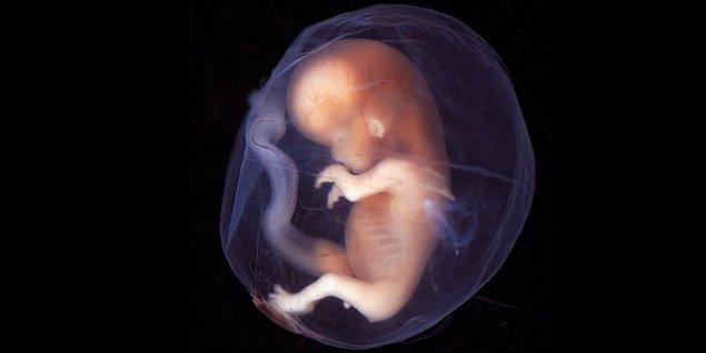 Öncelikle embriyoları dondurmak için nasıl bir işlem yapılıyor?