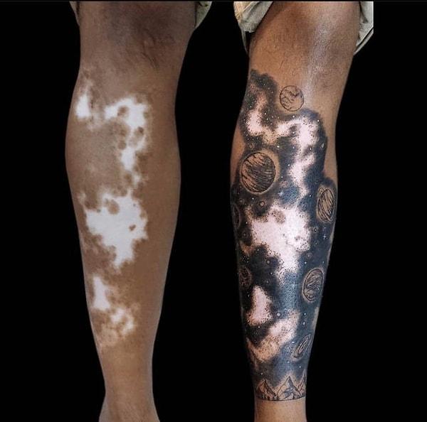 6. Vitiligo hastalığı izlerini bir sanat eserine dönüştürme fikri, iyi fikir.