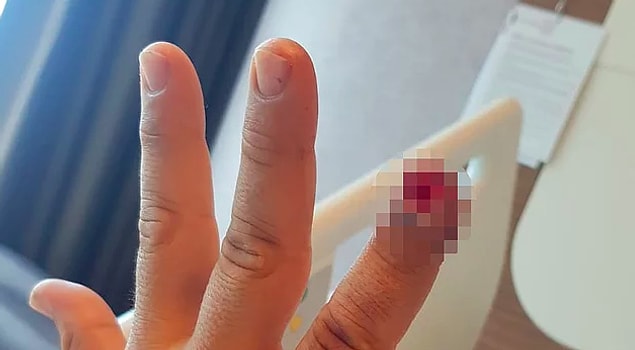 Saldırgan kadın tutuklandı
