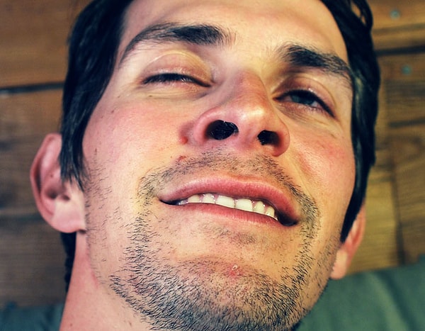 2. 30% людей могут раздуть ноздри по желанию. Однако эта мышца очень мало используется и обычно слаба, поэтому многие люди не могут этого делать