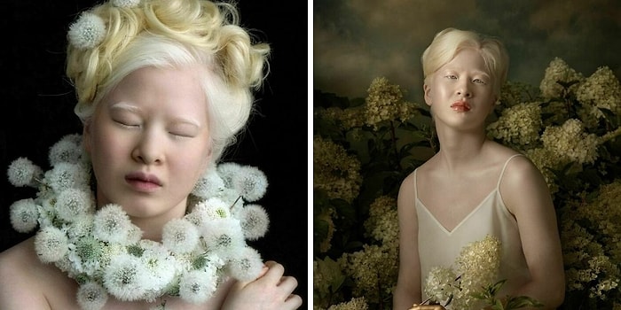 Брошенная в младенчестве из-за альбинизма девочка выросла, чтобы стать моделью Vogue (20 фото)