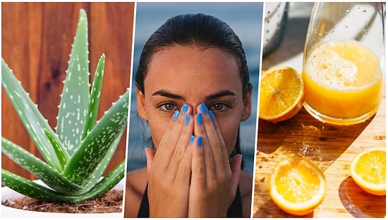 Aman Dikkat! Bu Sıcak Yaz Günlerinde Oluşan Güneş Yanıklarından Sonra Asla Yapmamanız Gerekenleri Söylüyoruz